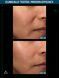 Сироватка мультипептидна з ефектом ліфтингу Multi Peptides & GF Advanced Lifting Serum PMPLS015EN01 фото 10